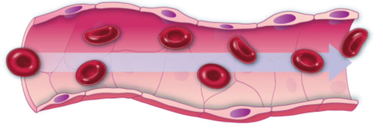 Diagramme zur Darstellung des Blutflusses unter normalen Bedingungen und der Bildung eines Blutgerinnsels bei TTP (Thrombotisch-thrombozytopenische Purpura)